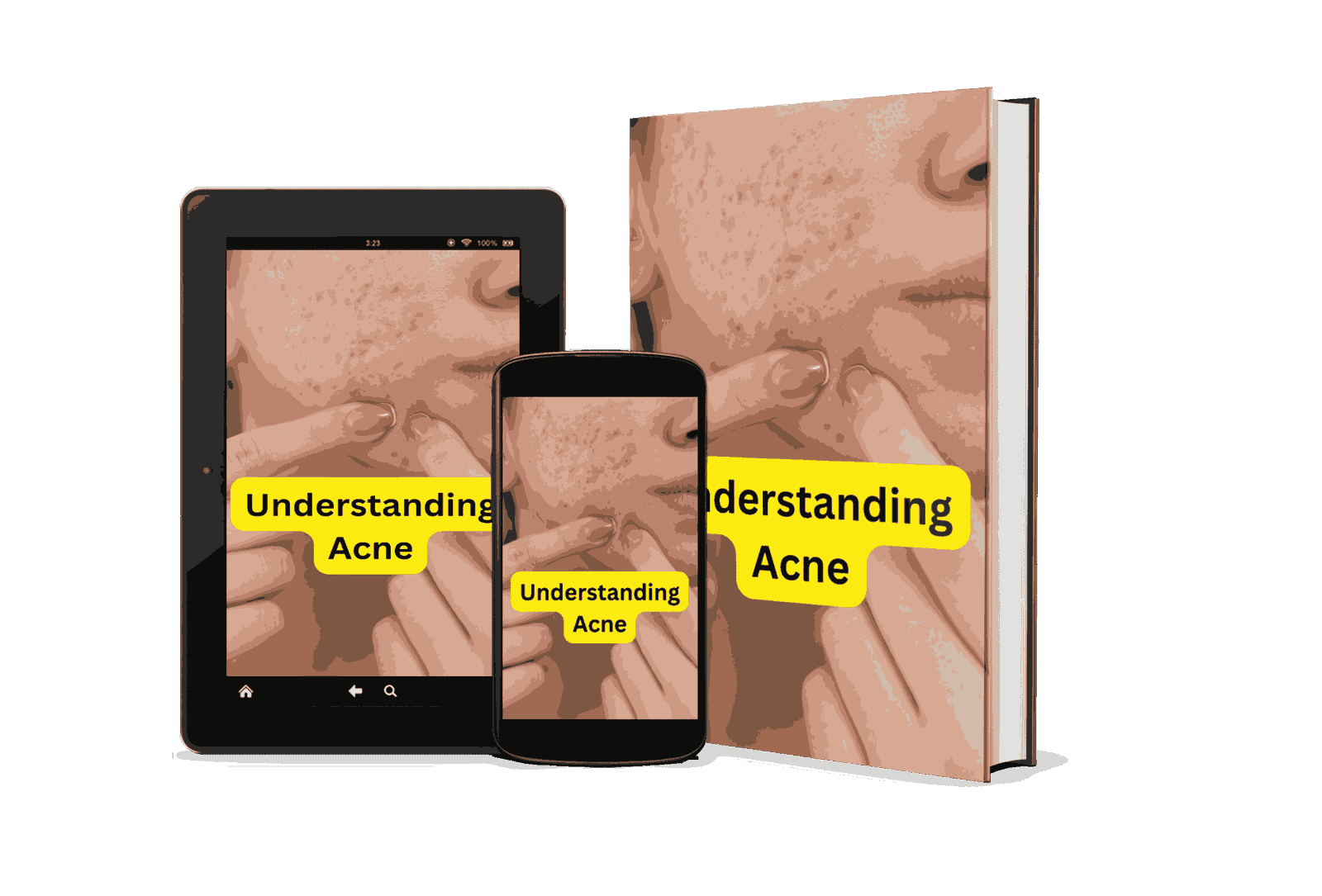 Understanding Acne